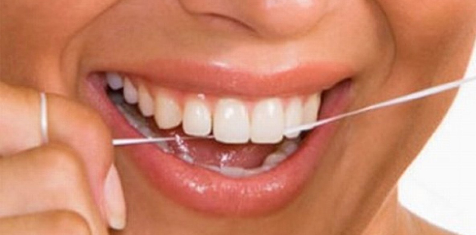 Uso correto do fio dental previne doenças bucais